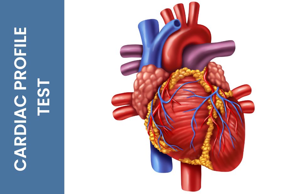 Cardiac Risk Profile Test