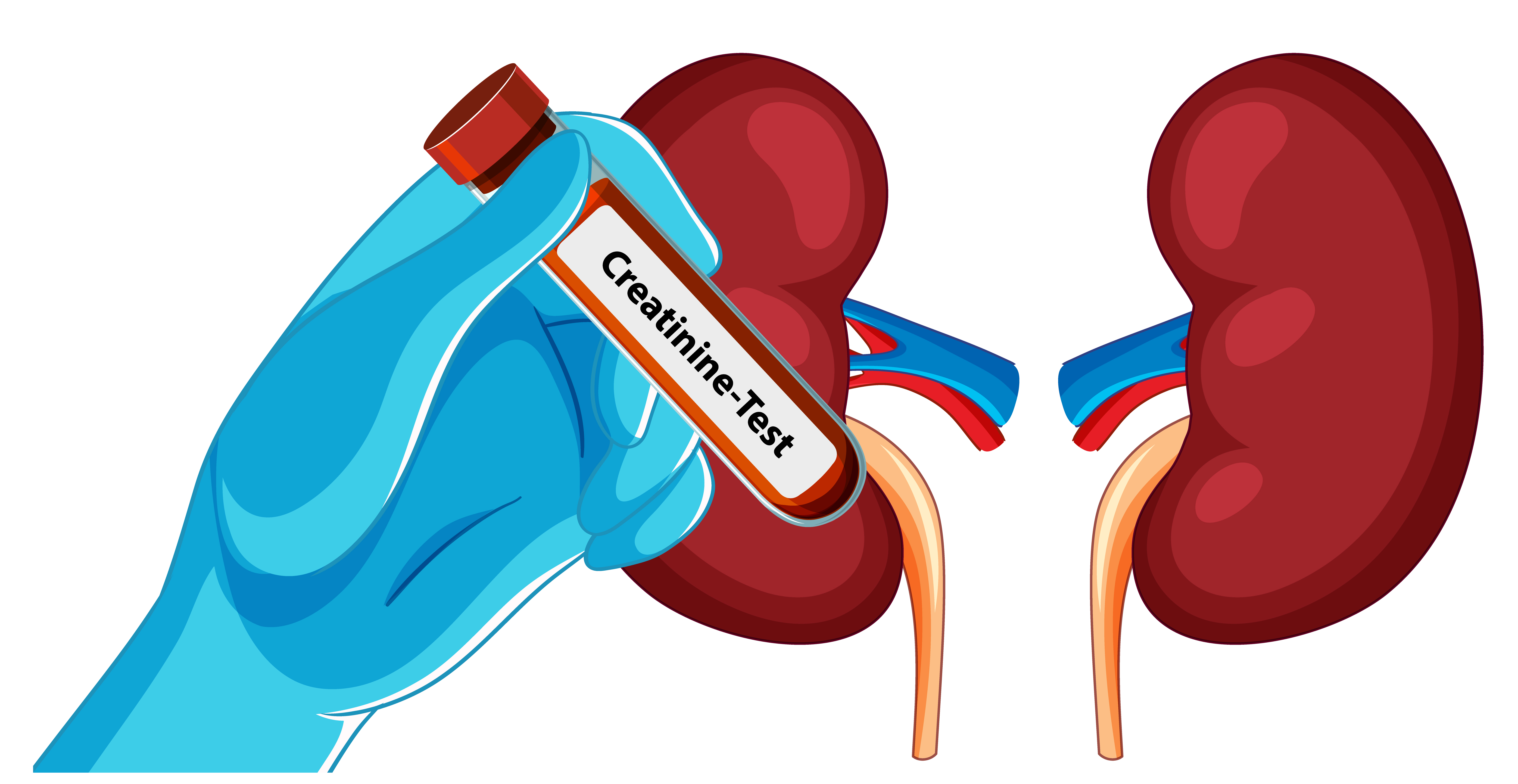 Kidney Profile Test