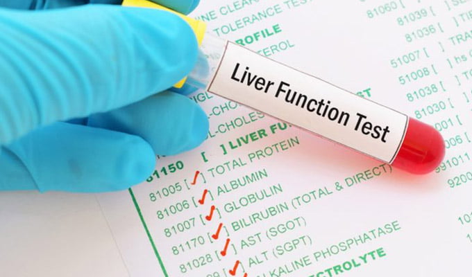 Liver Profile Test