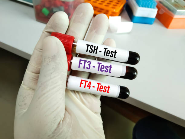 Thyroid Test